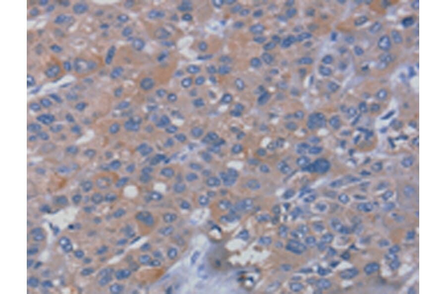 Immunohistochemistry - RHEB Antibody from Signalway Antibody (42737) - Antibodies.com