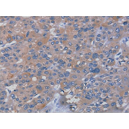 Immunohistochemistry - RHEB Antibody from Signalway Antibody (42737) - Antibodies.com