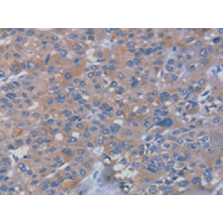 Immunohistochemistry - RHEB Antibody from Signalway Antibody (42737) - Antibodies.com
