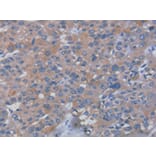 Immunohistochemistry - RHEB Antibody from Signalway Antibody (42737) - Antibodies.com