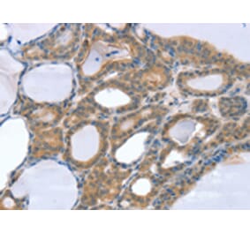 Immunohistochemistry - SNX4 Antibody from Signalway Antibody (42765) - Antibodies.com