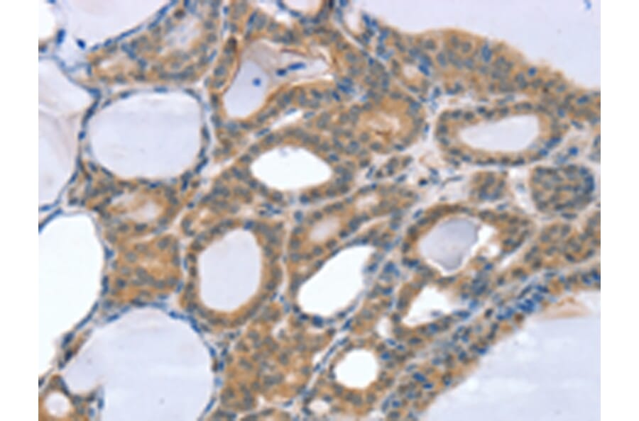 Immunohistochemistry - SNX4 Antibody from Signalway Antibody (42765) - Antibodies.com