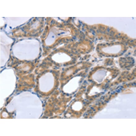 Immunohistochemistry - SNX4 Antibody from Signalway Antibody (42765) - Antibodies.com