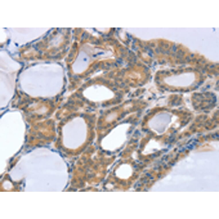Immunohistochemistry - SNX4 Antibody from Signalway Antibody (42765) - Antibodies.com