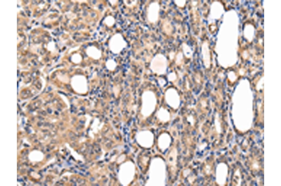 Immunohistochemistry - USF1 Antibody from Signalway Antibody (42816) - Antibodies.com