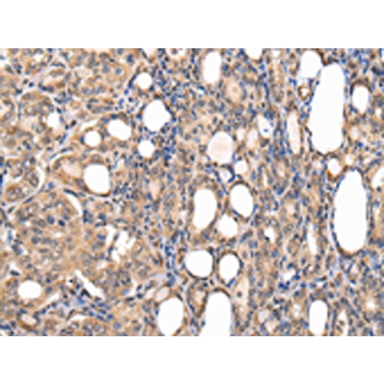 Immunohistochemistry - USF1 Antibody from Signalway Antibody (42816) - Antibodies.com