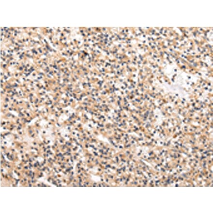 Immunohistochemistry - USP5 Antibody from Signalway Antibody (42820) - Antibodies.com