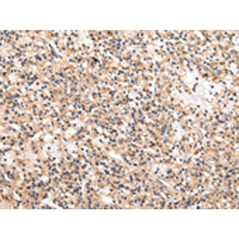 Immunohistochemistry - USP5 Antibody from Signalway Antibody (42820) - Antibodies.com