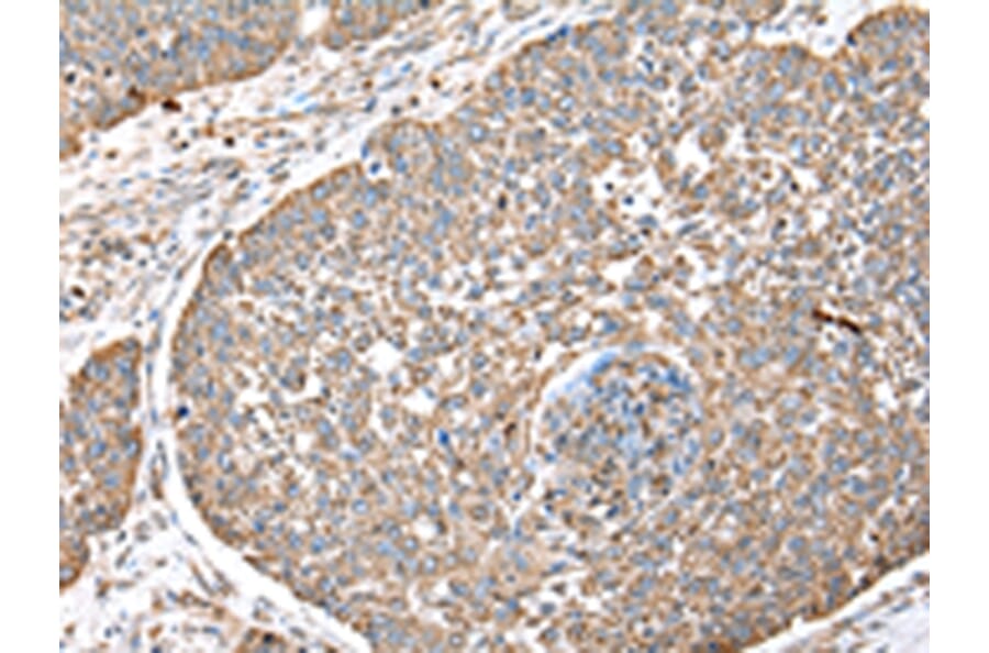 Immunohistochemistry - DPH7 Antibody from Signalway Antibody (42855) - Antibodies.com