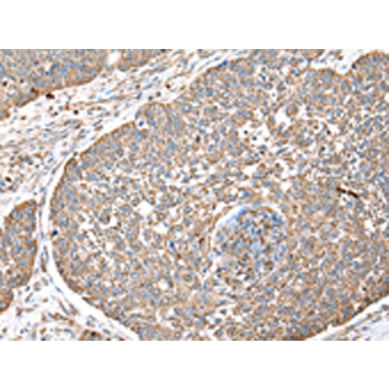 Immunohistochemistry - DPH7 Antibody from Signalway Antibody (42855) - Antibodies.com