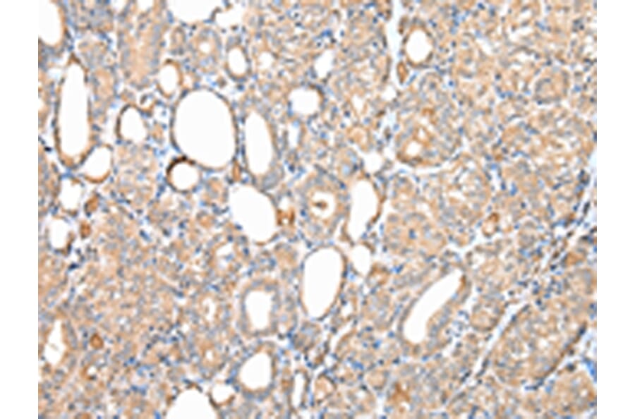 Immunohistochemistry - DPH7 Antibody from Signalway Antibody (42855) - Antibodies.com