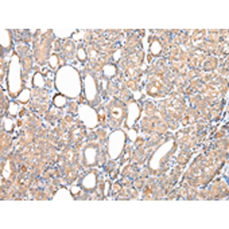 Immunohistochemistry - DPH7 Antibody from Signalway Antibody (42855) - Antibodies.com