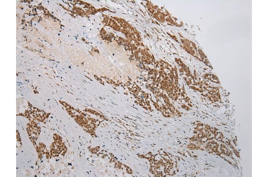 Immunohistochemistry - WSB1 Antibody from Signalway Antibody (42861) - Antibodies.com