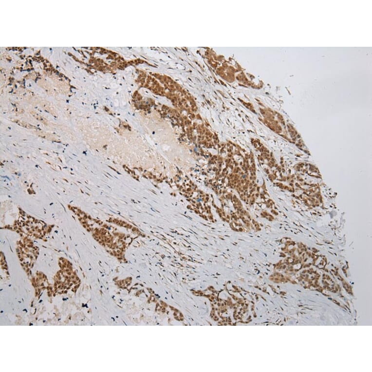Immunohistochemistry - WSB1 Antibody from Signalway Antibody (42861) - Antibodies.com