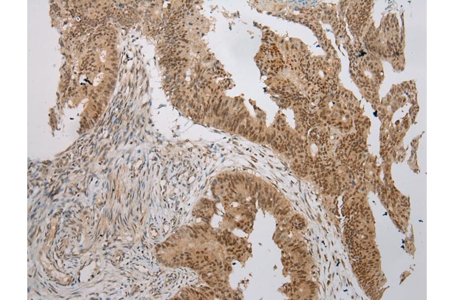 Immunohistochemistry - WSB1 Antibody from Signalway Antibody (42861) - Antibodies.com