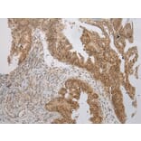 Immunohistochemistry - WSB1 Antibody from Signalway Antibody (42861) - Antibodies.com