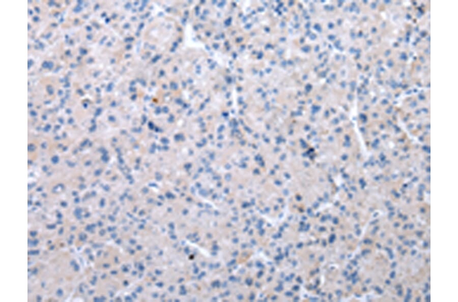 Immunohistochemistry - XKR6 Antibody from Signalway Antibody (42864) - Antibodies.com