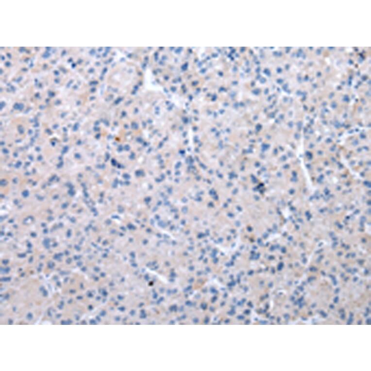 Immunohistochemistry - XKR6 Antibody from Signalway Antibody (42864) - Antibodies.com