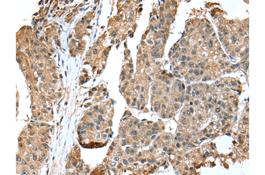 Immunohistochemistry - EML4 Antibody from Signalway Antibody (42885) - Antibodies.com