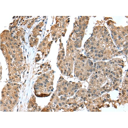 Immunohistochemistry - EML4 Antibody from Signalway Antibody (42885) - Antibodies.com