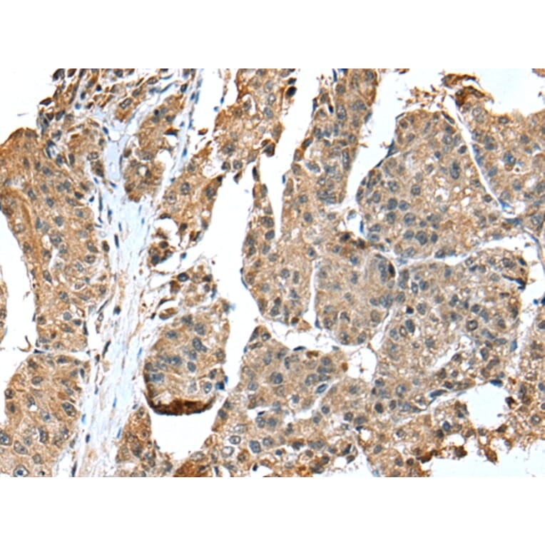 Immunohistochemistry - EML4 Antibody from Signalway Antibody (42885) - Antibodies.com