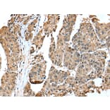 Immunohistochemistry - EML4 Antibody from Signalway Antibody (42885) - Antibodies.com