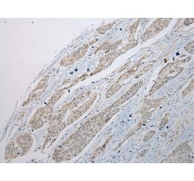 Immunohistochemistry - POMK Antibody from Signalway Antibody (42921) - Antibodies.com