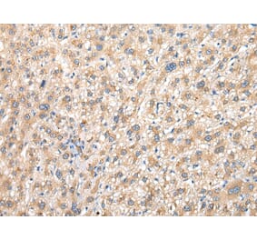 Immunohistochemistry - PRG3 Antibody from Signalway Antibody (42923) - Antibodies.com