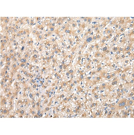 Immunohistochemistry - PRG3 Antibody from Signalway Antibody (42923) - Antibodies.com