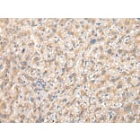 Immunohistochemistry - PRG3 Antibody from Signalway Antibody (42923) - Antibodies.com