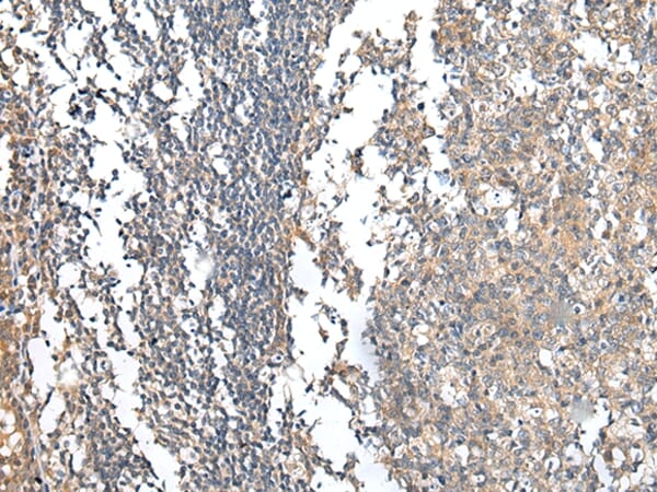 Immunohistochemical analysis of paraffin-embedded Human tonsil tissue using #42923 at dilution 1/30.