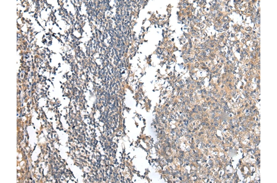 Immunohistochemistry - PRG3 Antibody from Signalway Antibody (42923) - Antibodies.com