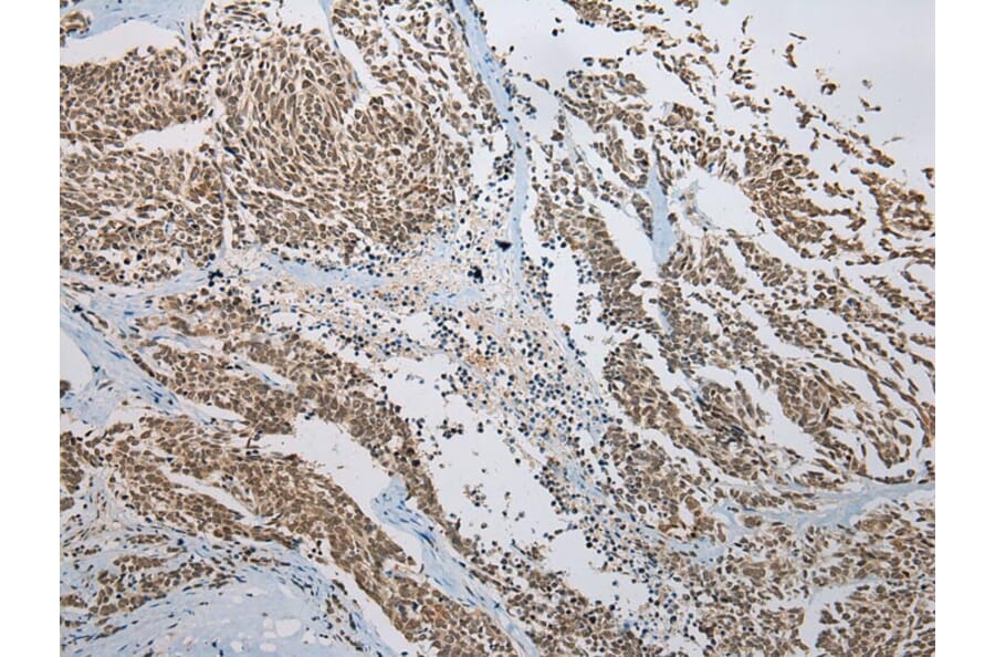 Immunohistochemistry - KAZN Antibody from Signalway Antibody (42929) - Antibodies.com