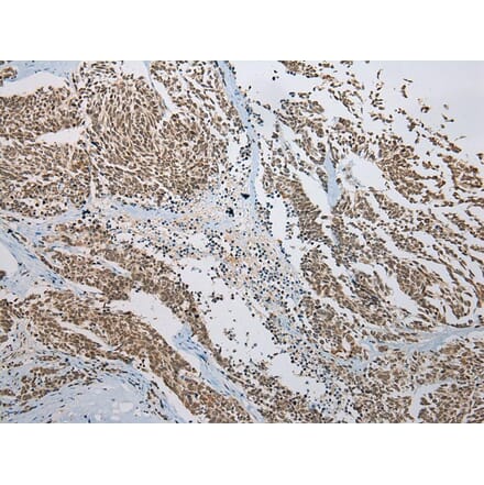 Immunohistochemistry - KAZN Antibody from Signalway Antibody (42929) - Antibodies.com