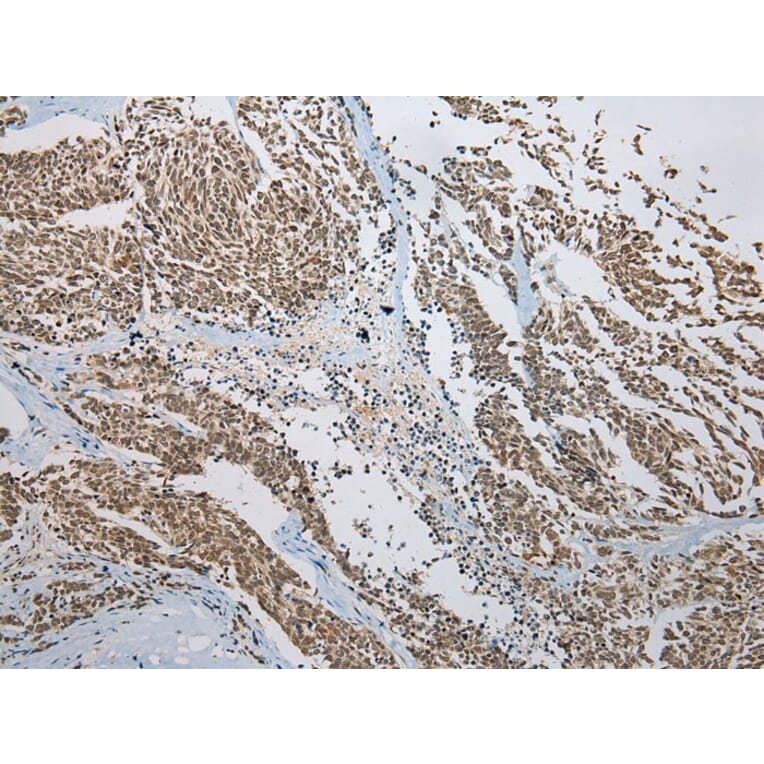 Immunohistochemistry - KAZN Antibody from Signalway Antibody (42929) - Antibodies.com