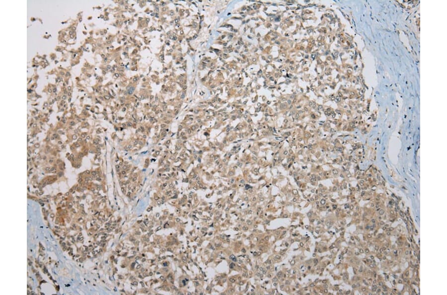 Immunohistochemistry - KAZN Antibody from Signalway Antibody (42929) - Antibodies.com