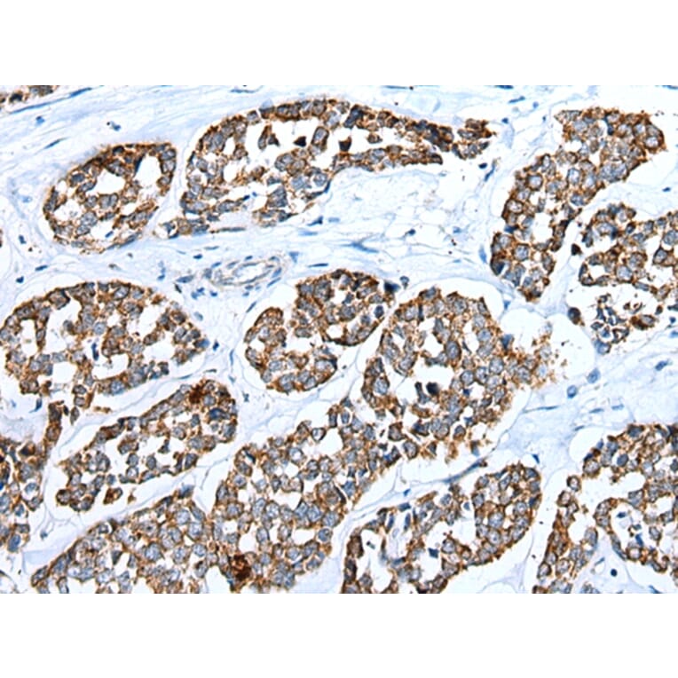 Immunohistochemistry - RHOV Antibody from Signalway Antibody (42948) - Antibodies.com