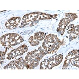 Immunohistochemistry - RHOV Antibody from Signalway Antibody (42948) - Antibodies.com