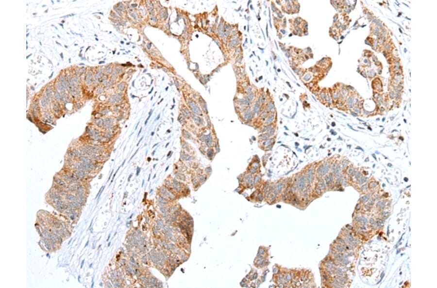 Immunohistochemistry - RHOV Antibody from Signalway Antibody (42948) - Antibodies.com