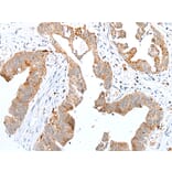 Immunohistochemistry - RHOV Antibody from Signalway Antibody (42948) - Antibodies.com