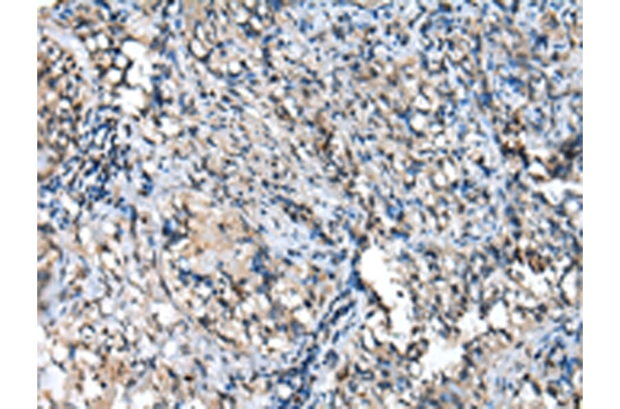 Immunohistochemistry - TPPP Antibody from Signalway Antibody (42950) - Antibodies.com