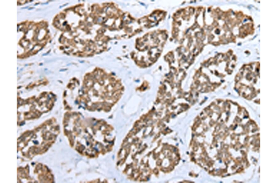 Immunohistochemistry - TPPP Antibody from Signalway Antibody (42950) - Antibodies.com