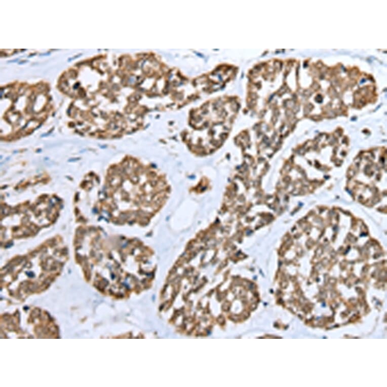 Immunohistochemistry - TPPP Antibody from Signalway Antibody (42950) - Antibodies.com