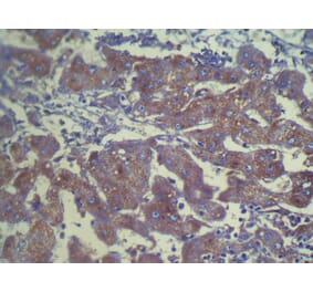 Immunohistochemistry - DHDH Antibody from Signalway Antibody (42959) - Antibodies.com