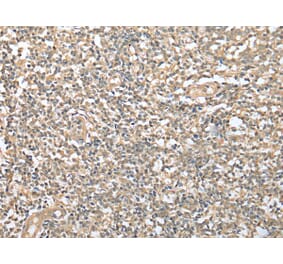 Immunohistochemistry - DPYD Antibody from Signalway Antibody (42963) - Antibodies.com