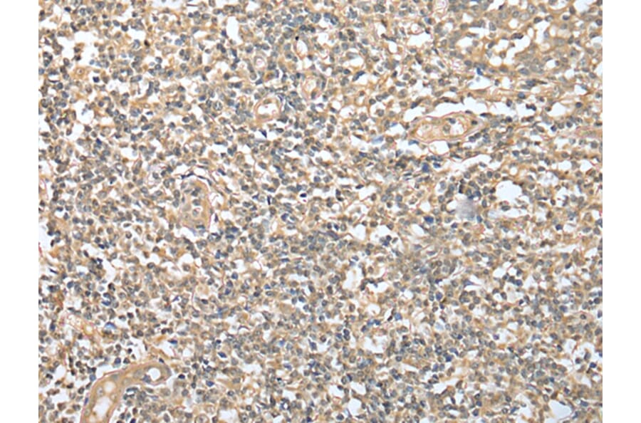 Immunohistochemistry - DPYD Antibody from Signalway Antibody (42963) - Antibodies.com