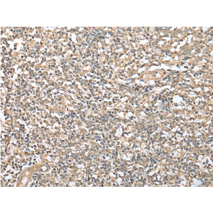 Immunohistochemistry - DPYD Antibody from Signalway Antibody (42963) - Antibodies.com