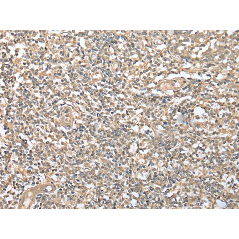Immunohistochemistry - DPYD Antibody from Signalway Antibody (42963) - Antibodies.com