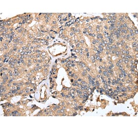 Immunohistochemistry - TESC Antibody from Signalway Antibody (42973) - Antibodies.com