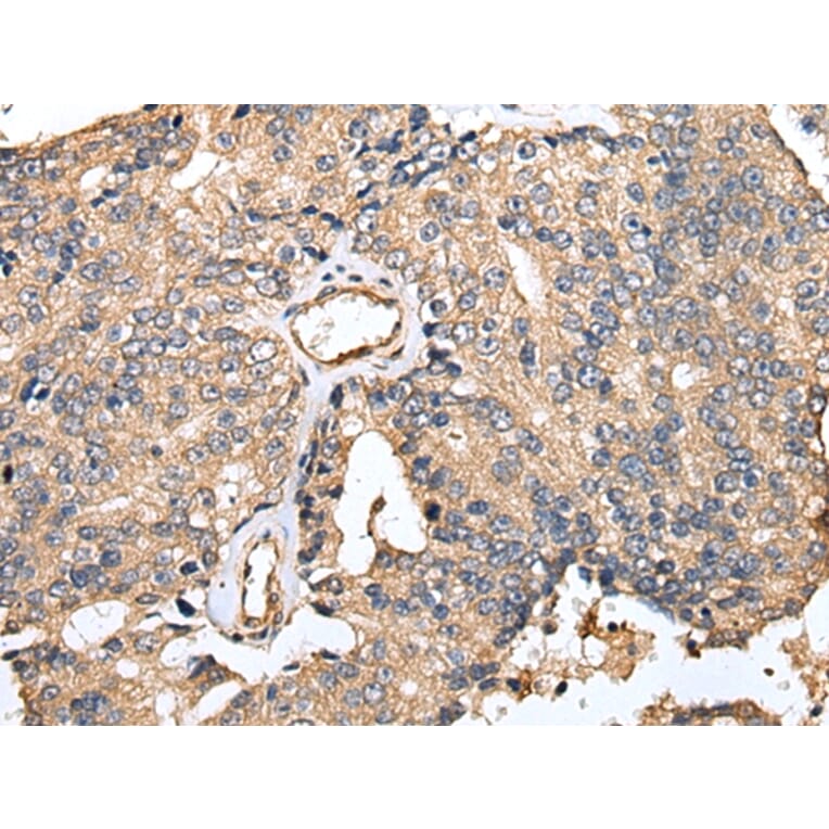 Immunohistochemistry - TESC Antibody from Signalway Antibody (42973) - Antibodies.com